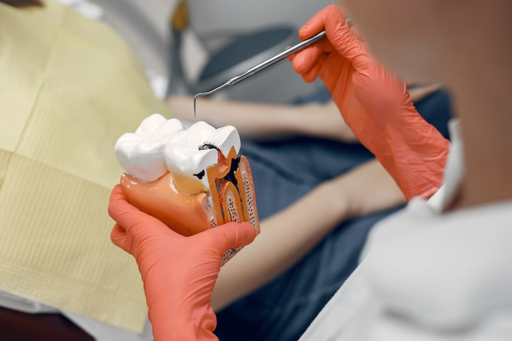 Smile Makeover Options